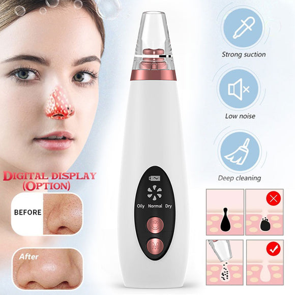 Vacuum Blackhead Remover Nose Pore Cleaner Jennyshome